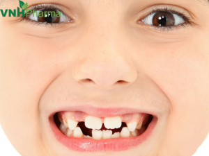 Một số mẹo giúp trẻ nhanh mọc răng