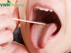 5 nguyên nhân trẻ bị viêm amidan hốc mủ ba mẹ cần lưu ý ngay